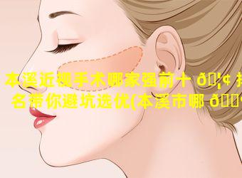 本溪近视手术哪家强前十 🦢 排名带你避坑选优(本溪市哪 🌺 个医院能配眼镜)